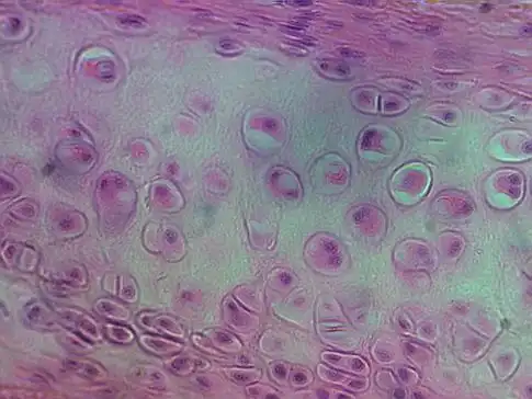 p>透明软骨(hyaline cartilage)分布较广,成体的 a href="#" data