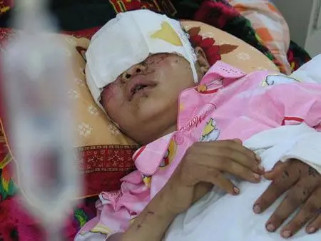 少女遭强奸挖眼案凶手被执行死刑