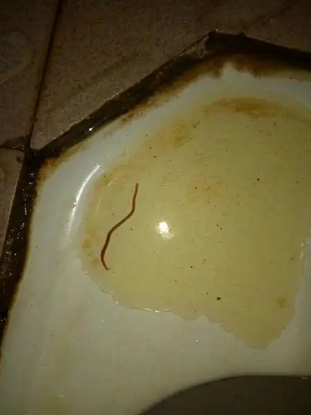 尿 男士 尿出一条红色的虫子 头像吸盘 2--3cm长 还蠕动 本人身体没