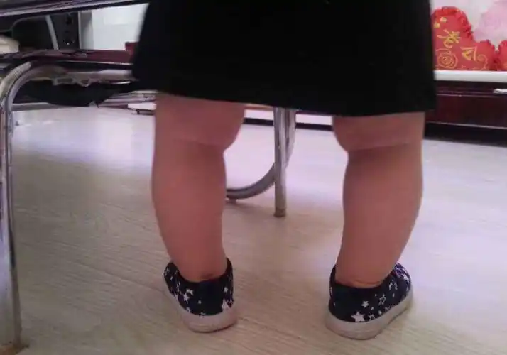 新生儿腿弯曲正常图片(3大误区影响宝宝腿部发育) - 赤虎壹号