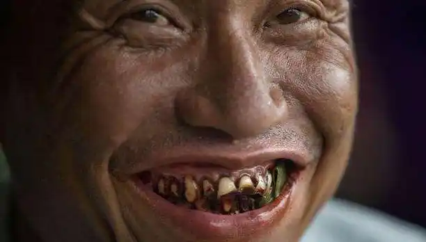 割掉我的舌头,打碎我的牙齿,我也绝不会戒掉槟榔!