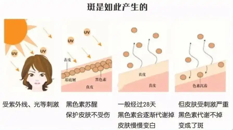 皮肤,避免直接在阳光下暴晒,紫外线能促进黑色素细胞产生黑色素颗粒