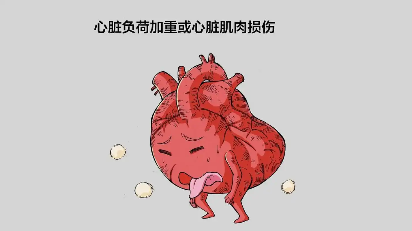 当您的心脏功能不足以满足生理需要了,它衰竭了,就是心衰,当然心衰是