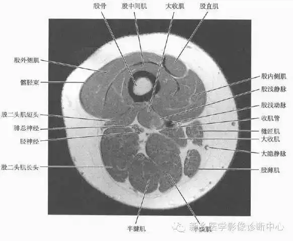 大腿解剖·详细标注