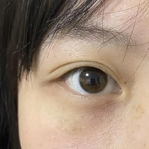 美女们我这种眼下细纹怎么搞啊01