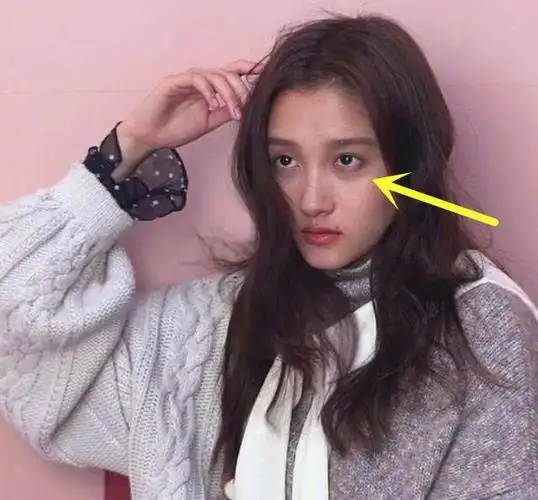 关晓彤生图吓坏网友!这黑眼圈确定是97年的?粉丝:鹿晗这锅不背