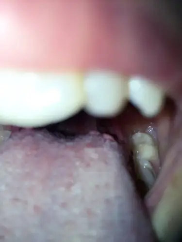 我最近胃很难过 总是觉得很饿 饿到直不起腰但是