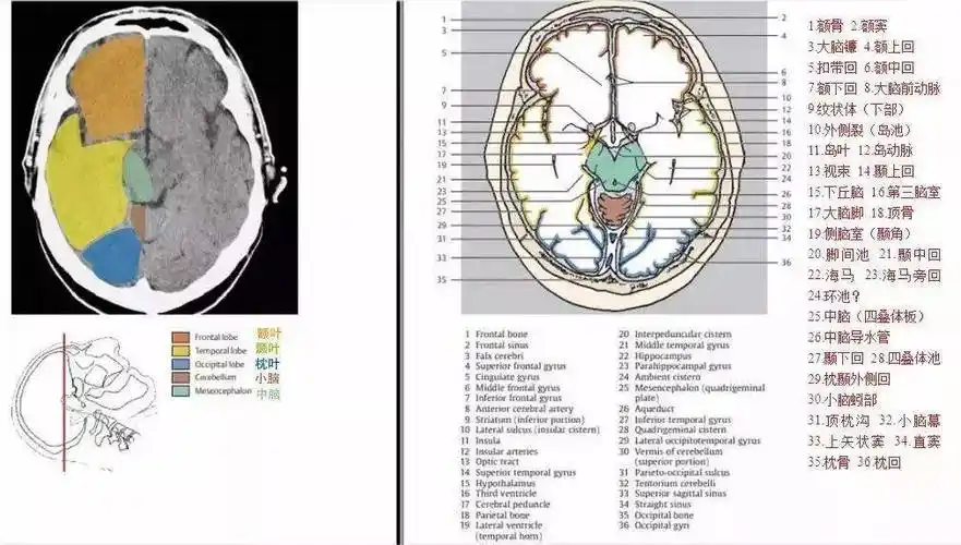 颅脑ct断面解剖彩色图谱
