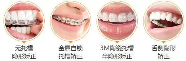 牙齿矫正前后对比图