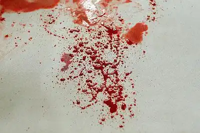 aluuuuuuuuuuuu的相册-冷知识课堂:如何鉴定凶案现场血迹!