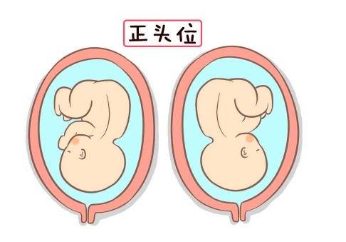 胎儿头位是什么样子的_莎莉欣月-北京专业月子中心