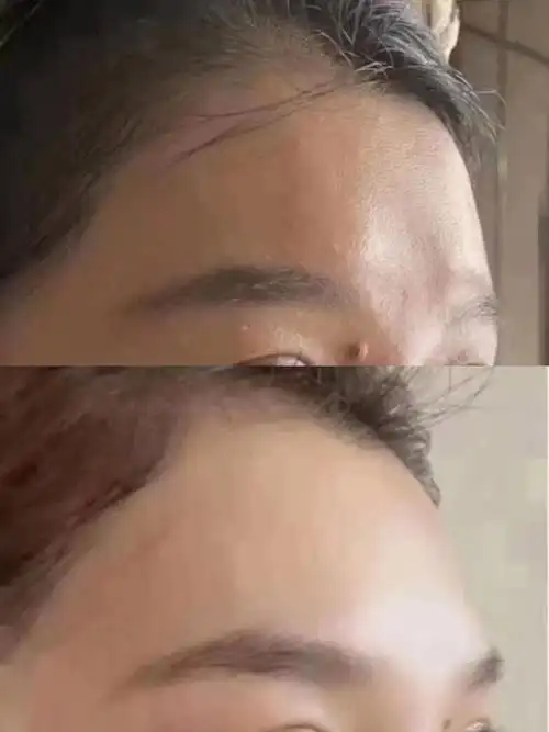 额头眉心经常皱眉有些凹陷下塌很显老气
重要的是想要福气满满的