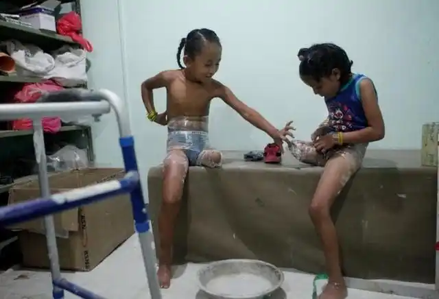 1/8 直击两个截肢女孩的8张催泪生活照