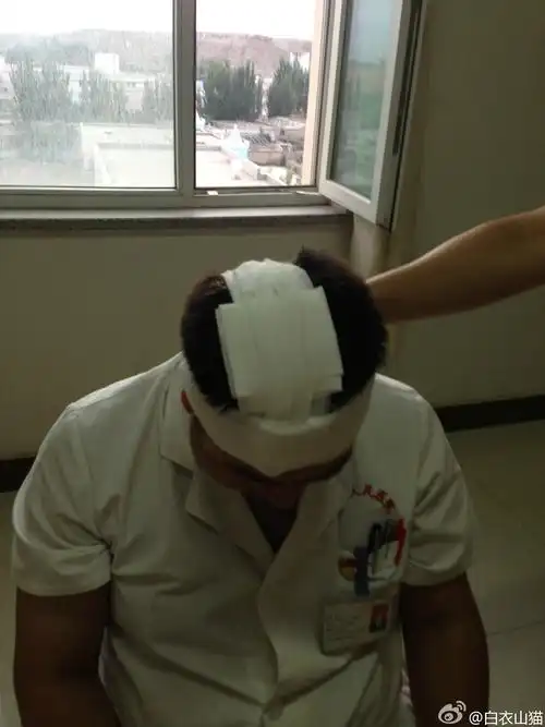 最后的加压包扎效果如图.