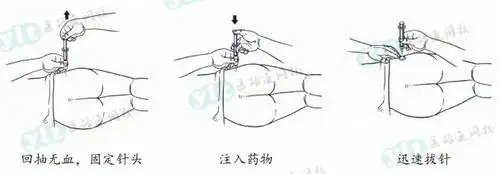 乡村全科技能第三站肌内注射操作要点图解