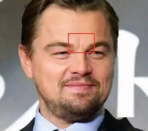 眉头下沉,这两块肌肉长期紧张,会导致眉心出现川字皱纹,山根出现横纹