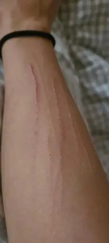 讨论猫猫喜欢挠人咬人改怎么纠正呢有被挠伤图慎入