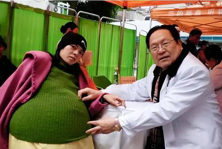 2009年广东女子挺55公斤巨肚,怀孕11月未生,医生检查看不见孩子