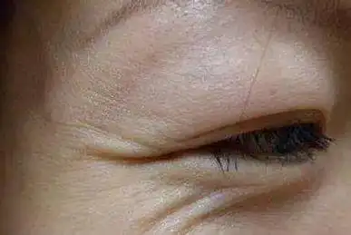 鱼尾纹,在面相中通常代表的是一个人中晚年的运势,但若是一个人的