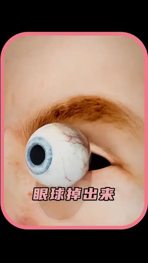 当眼球突然掉了,眼前会是一片漆黑吗?