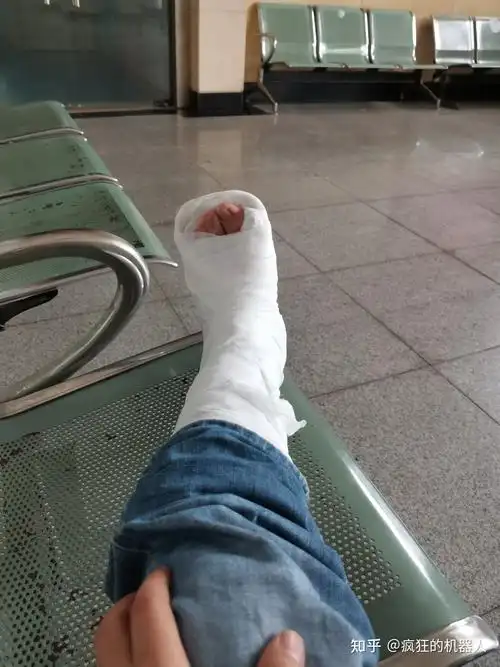 医生说,打石膏固定,回去躺着,不要下地,不要走路,十一点五十的时候,去