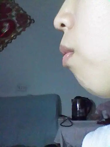 大夫您好,我今年27岁了,我的嘴有点鼓,牙床突出,门牙有点大,也突.