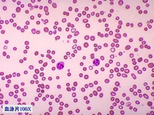 血涂片的制作ppt