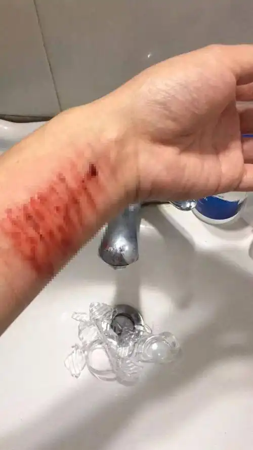 永嘉一男子在朋友圈直播"割腕自杀"!