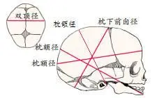 双顶径  向下滑动查看参考答案 ↓ ↓↓ ↓↓↓↓ 答案:e  解析:胎头