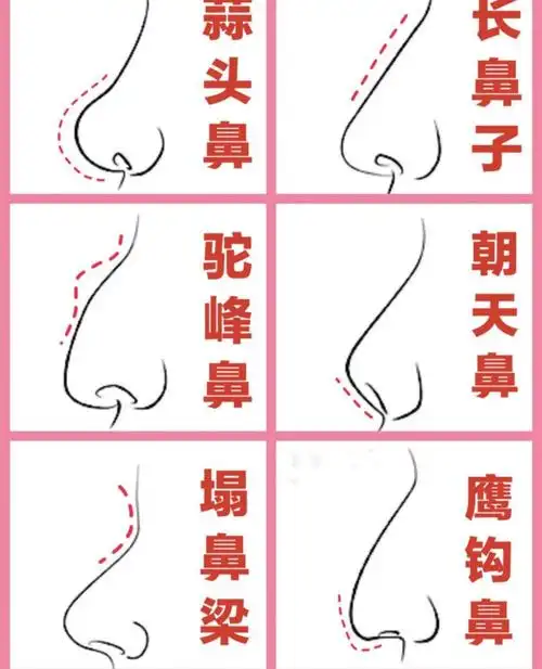 不良鼻型中 你属于哪一种?