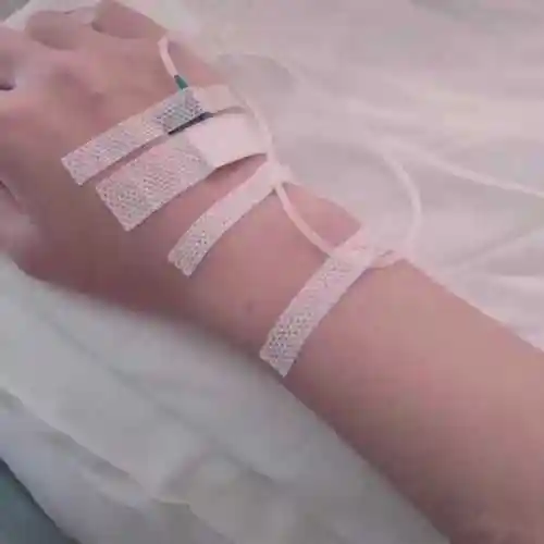 打吊瓶真实图片软件下载-打吊瓶真实图片女手/男士输液高清版下载