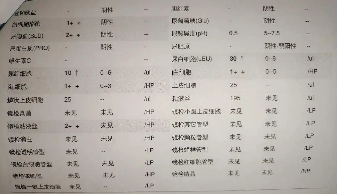姐妹们尿隐血2 没事吧,会影响入职吗 我的入职体检啊医生当时看报告不