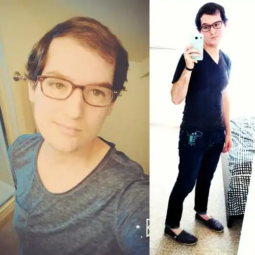 亮瞎眼!男子服用雌激素一年 抠脚大汉变娇娘