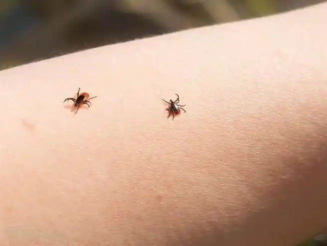 被蜱虫咬后真的会死人吗?身体不适千万要去医院检查!