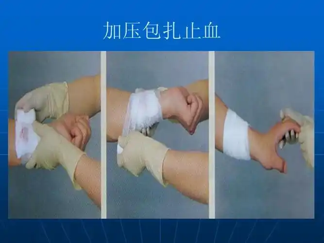 基本创伤急救技术ppt_word文档在线阅读与下载_无忧文档