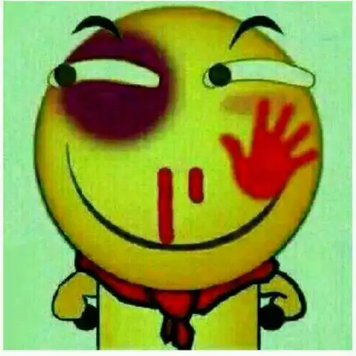 奸笑gif鼻青脸肿gif受伤gif可恶gif