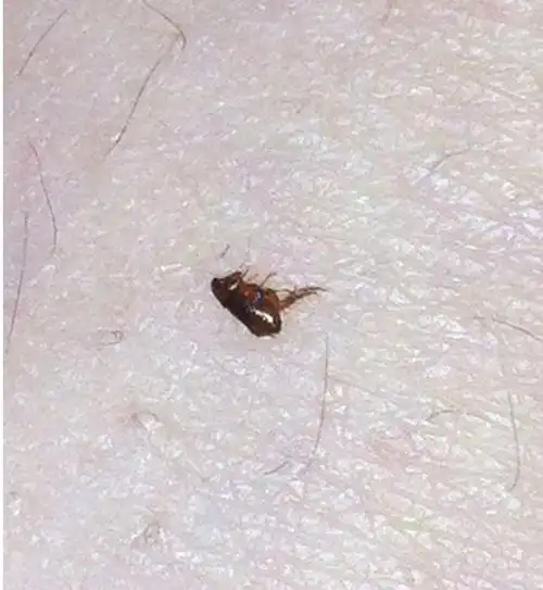 怎么辨别猫身上是否有跳蚤