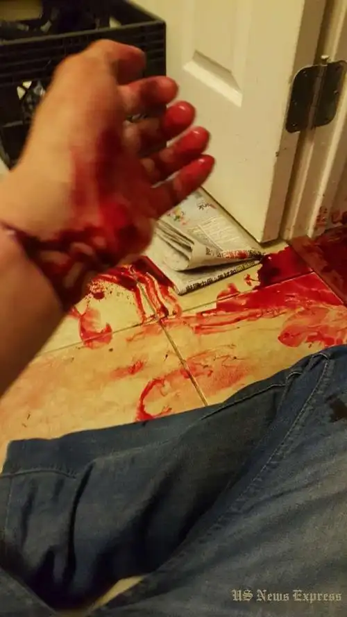 凌晨群聊,洛杉矶华男微信直播血腥切腕 (慎入)