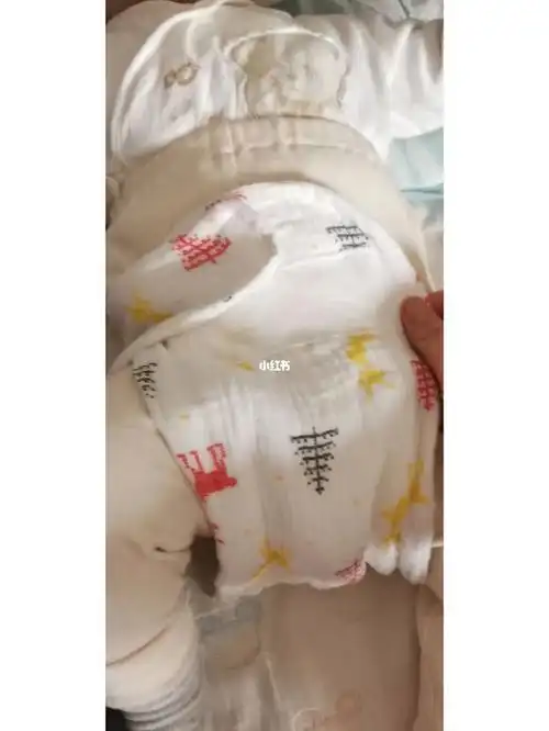 肛周脓肿,不穿纸尿裤新方法