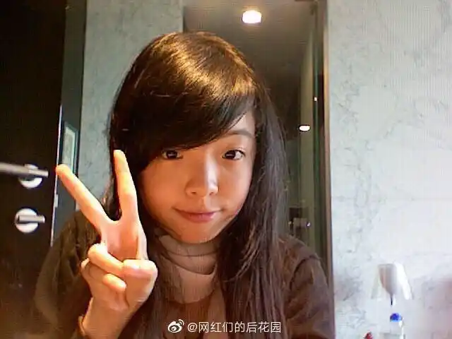 王文也这是什么拉眼距整容术吗