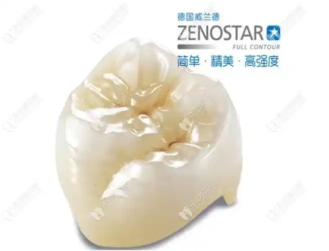 威兰德全瓷牙1200/1600/2800元是真的吗?还是淘宝上买的更靠谱