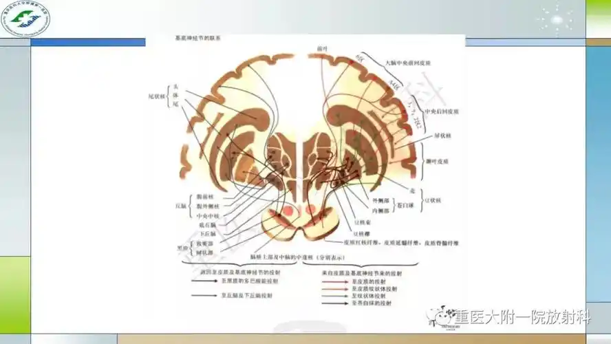 双侧基底节区对称性病变的鉴别诊断