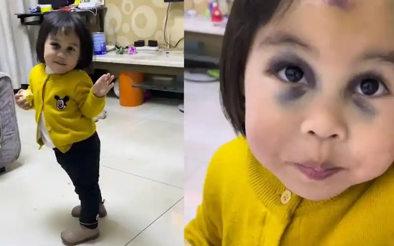 小女孩摔跤成"熊猫眼",又可怜又好笑,网友:酷似林正英片里的小僵尸