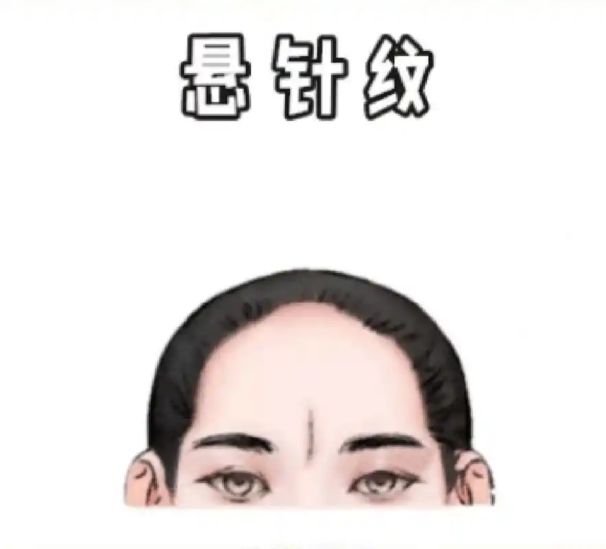 就是指在额头正中间的位置处有竖纹直接插入到印堂的位置,有"悬针破印