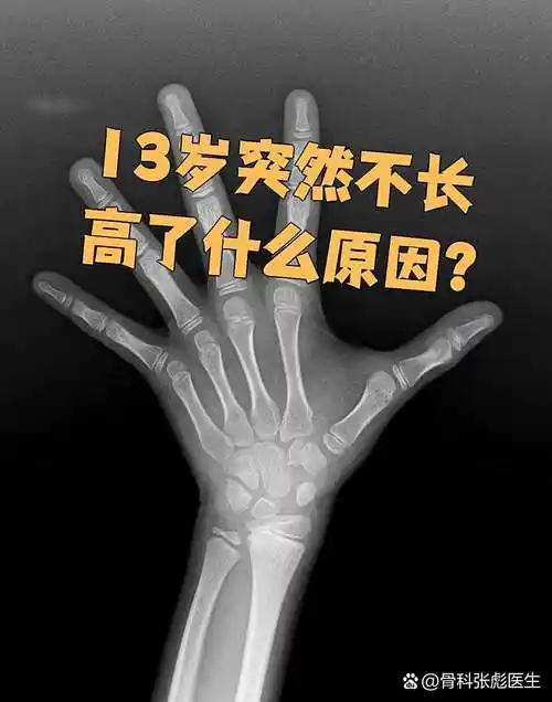 13岁的孩子突然不长高了,最常见的原因是骨龄闭合