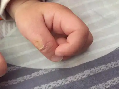 婴儿能不能吃手?不让孩子吃手有三个不良后果,几年后会变本加厉