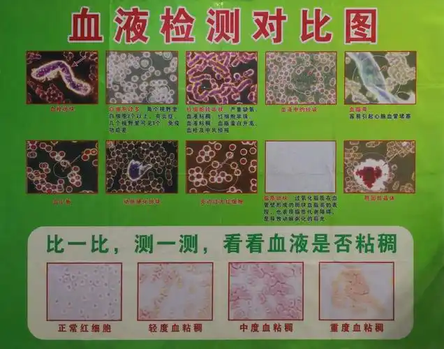 血粘稠十分钟测试图