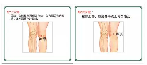 膝关节疼痛患者,不妨试试艾灸这些穴位!