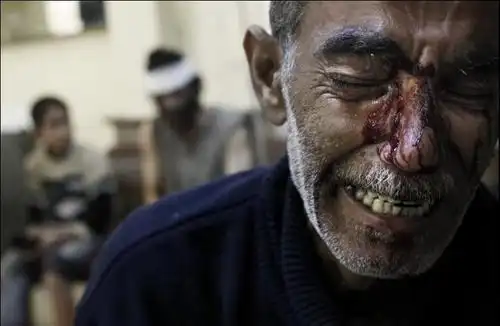 美国摄影师javier manzano 凭组图《包围阿勒颇》获得突发新闻类组照