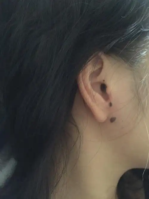 有皮肤科医生能帮忙看下这个是痣安全吗!长了很多年了,最下面两颗偶_